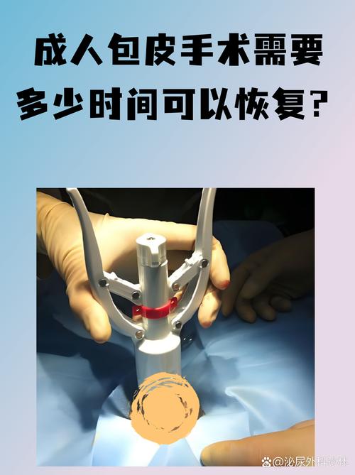 飞牛刮削成人一般用多少天