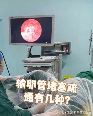 输卵管堵塞了怎么疏通截图2