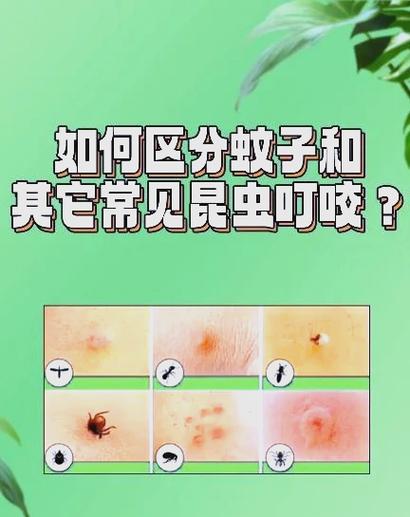 家里有虫子咬人但找不到