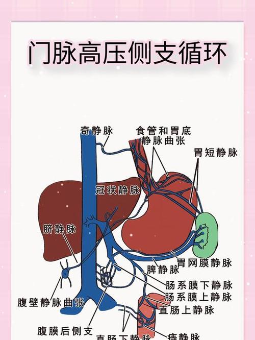 最能代表门脉高压的症状