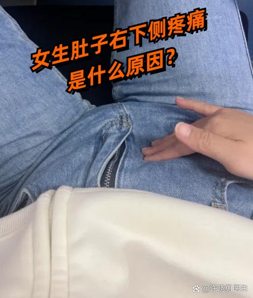 女性右侧疼痛位置图