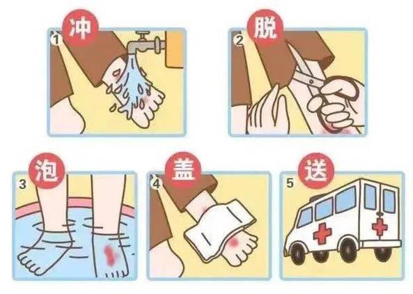 烫伤可以盖被子不可以