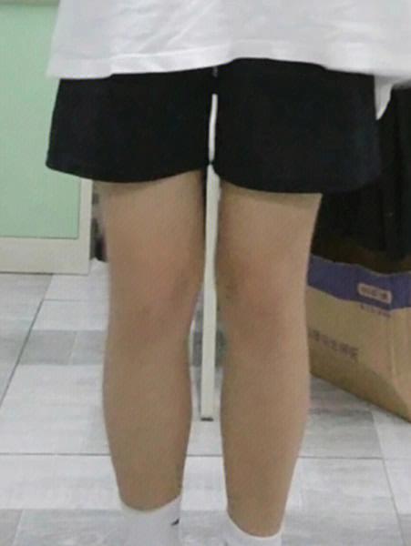 男生腿细怎么增粗