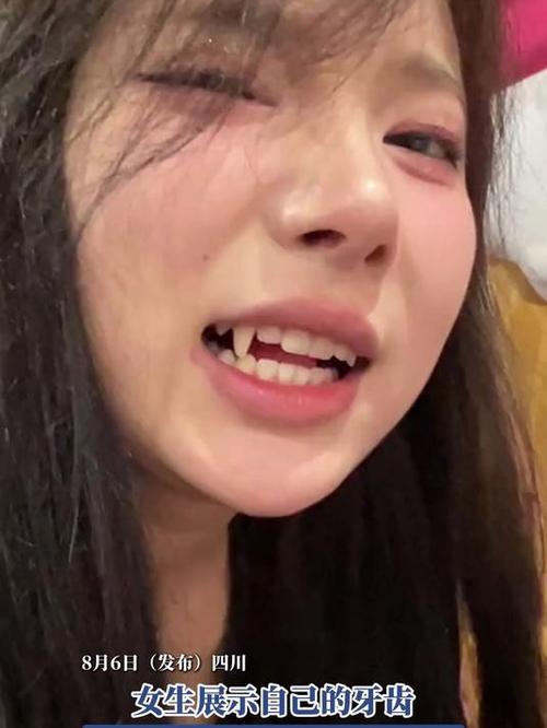 虎牙是哪颗牙齿
