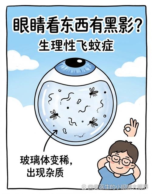 眼睛里面有黑影怎么办