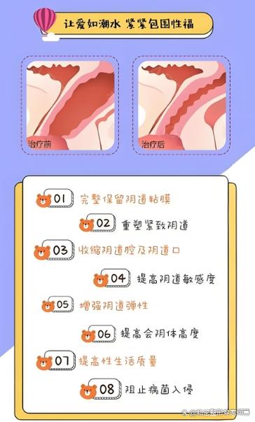 紧缩手术功效