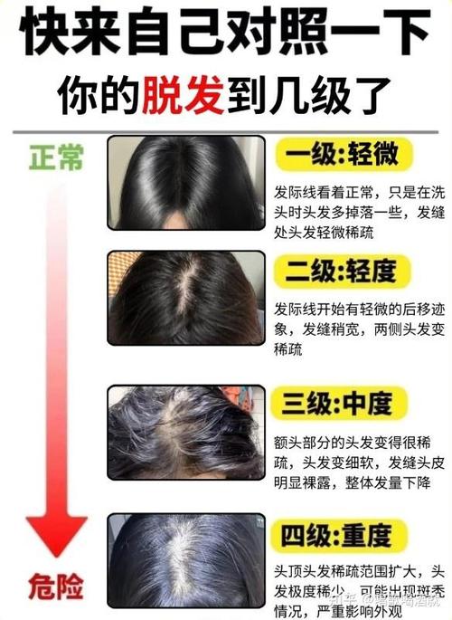 头发稀少怎么办才能变浓密
