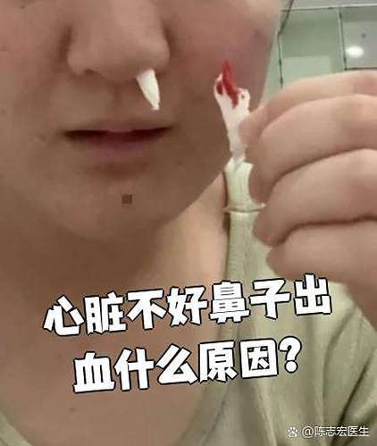 被电击会流鼻血吗