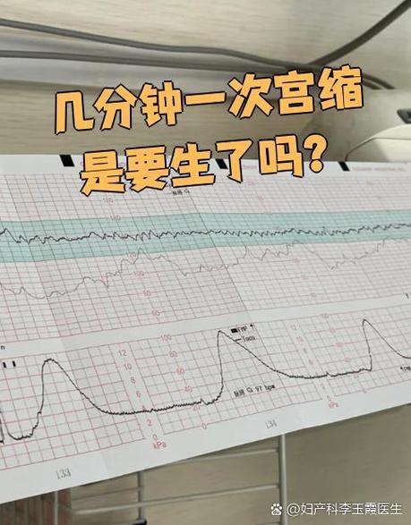 宫口软是不是快要生了截图3