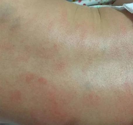婴儿几个月可以摸宝宝霜