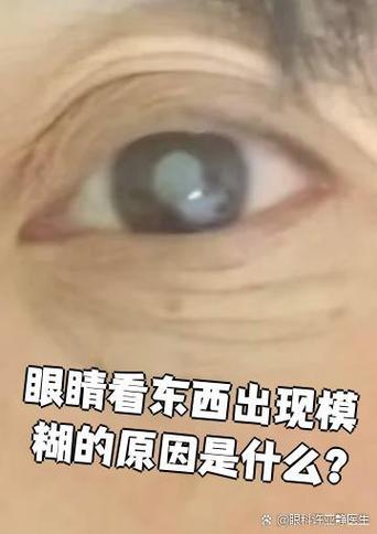 眼睛看东西边缘有虚影