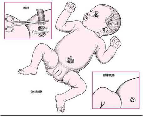 宫外孕打针一般打几针