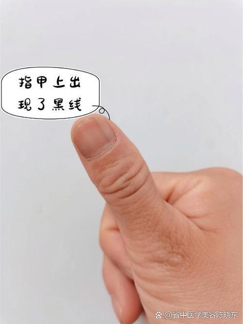 图片怎么加黑线