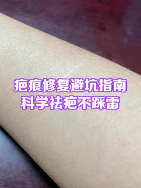 红色疤痕一般多久消失