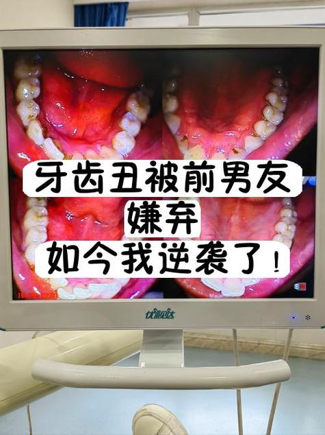 嫌弃男友长得丑想分手