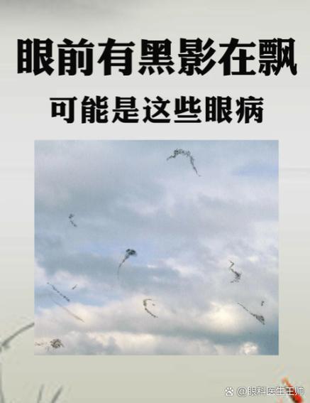 眼睛前老是有黑影飘动