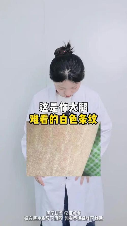 西瓜里有白色一条的东西