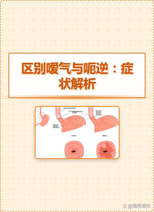 嗳气和呃逆症状的区别