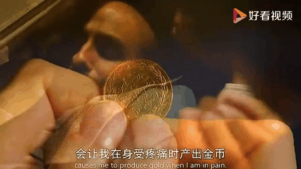 受到疼痛就会吐金币 受到疼痛就会吐金币