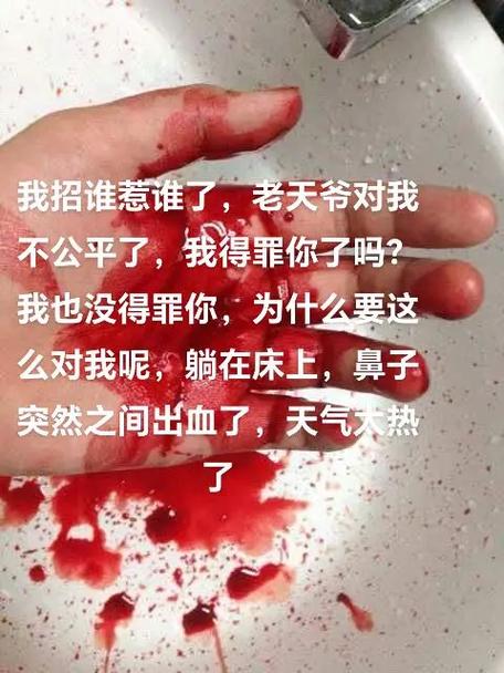 凌晨流鼻血是什么征兆