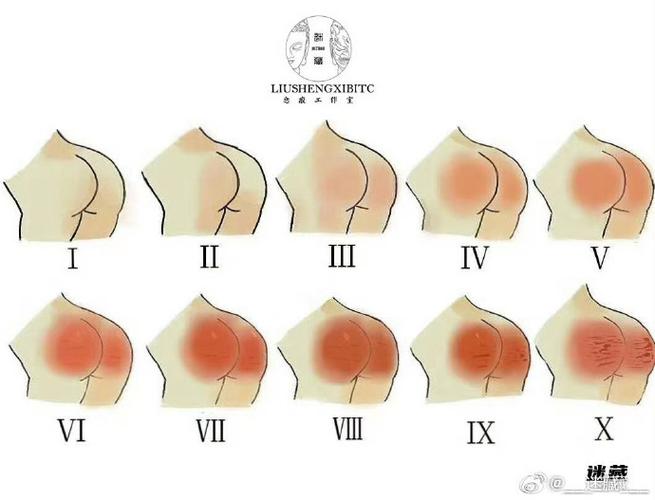 SP屁股打破皮什么程度