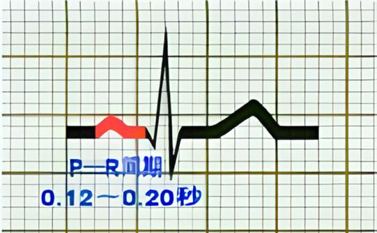 pr间期高限值是什么意思