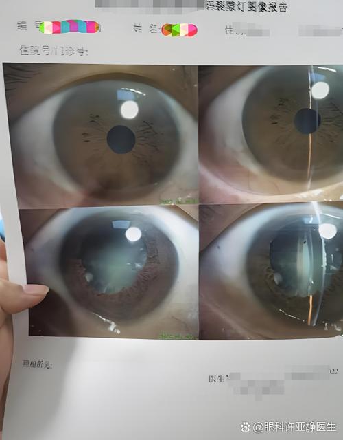看东西有重影是怎么回事