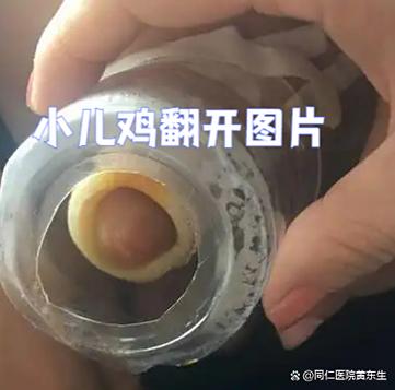鸡儿发红是什么原因引起的