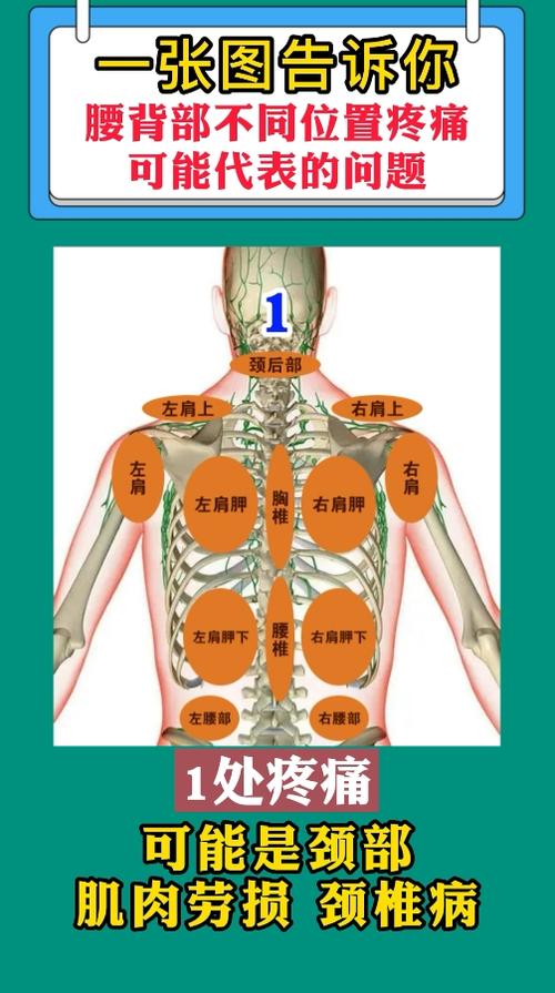 身体部位疼痛对应图