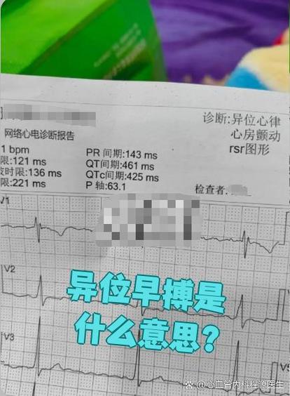 心脏起搏异常
