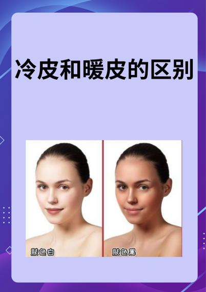 暖皮是白皮还是黄皮