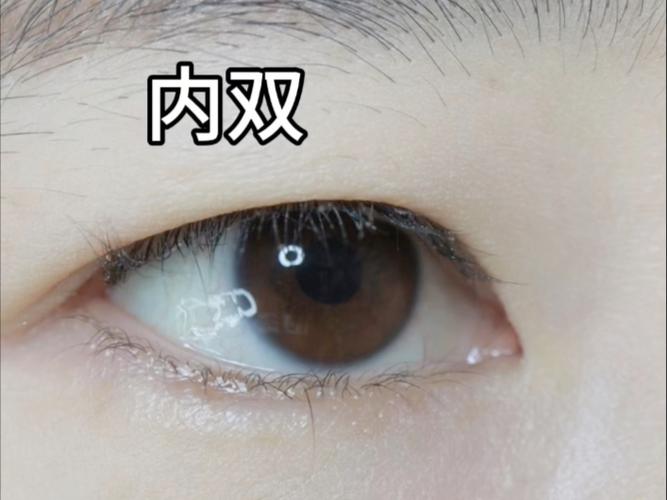 内双突然变成外双好几天了