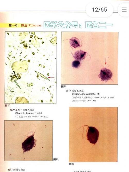 怎么判断人体有寄生虫