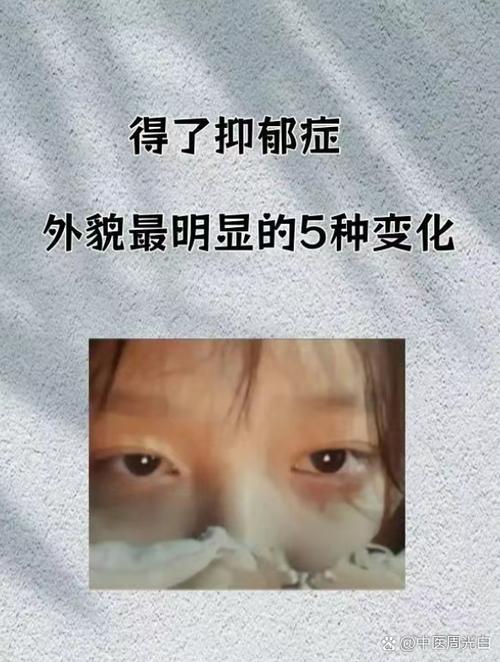 抑郁症的孩子外表变化