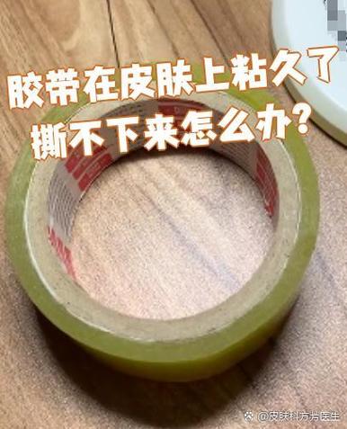 胶带撕不下来
