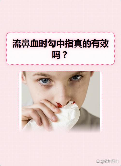 流鼻血有什么民间单方截图3