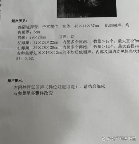 子宫液性暗区多少cm正常