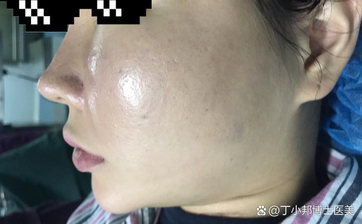 激活细胞的针能打吗