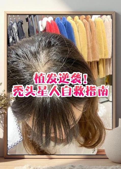 防秃指南
