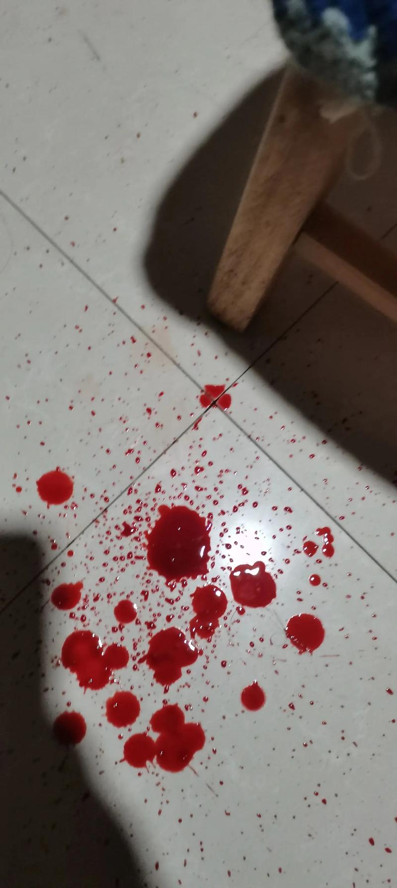 如何让鼻血快速止住