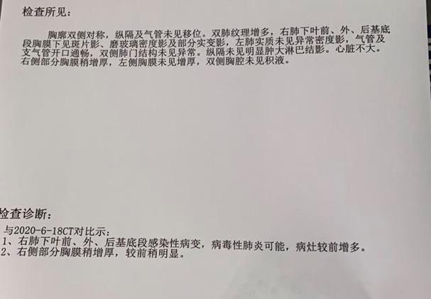 人民日报病毒性肺炎