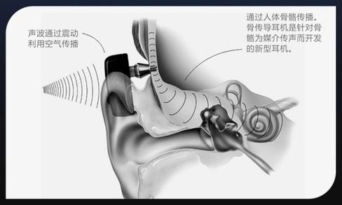 骨传导耳机骨架坏了怎么办