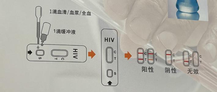 人体免疫缺陷病毒抗体