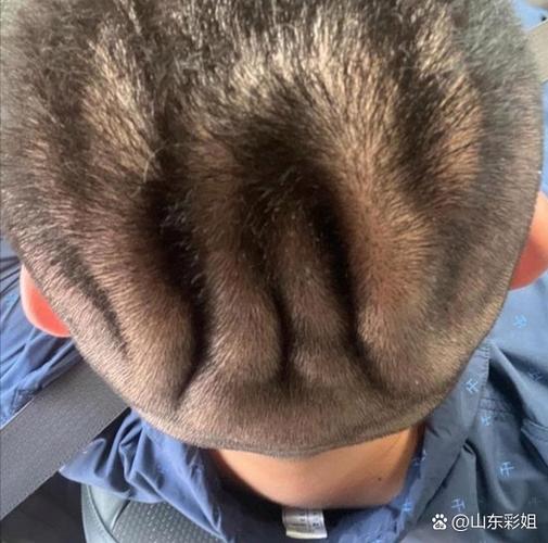 后脑突出来的人聪明吗