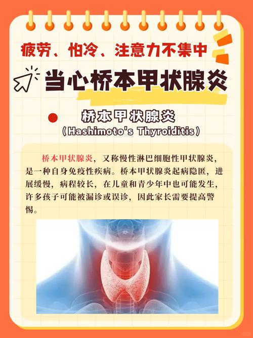 甲状腺桥本病严重吗