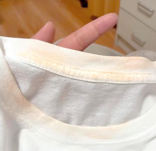 白色衣服挂久了容易变黄截图2