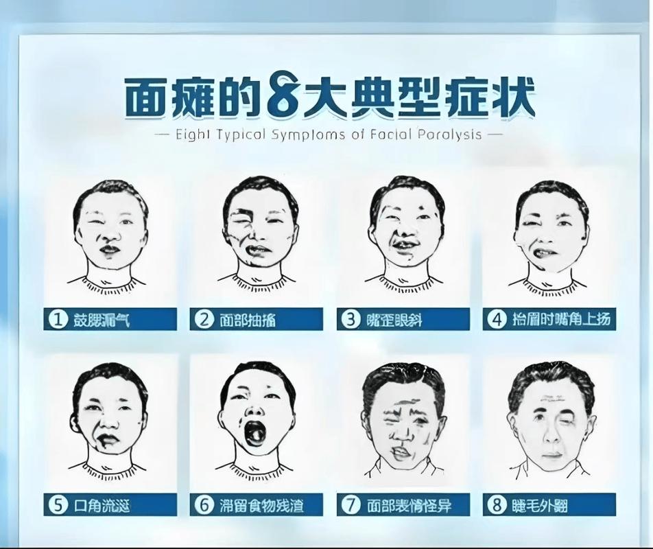 面部不自觉的抽搐抖动是什么病