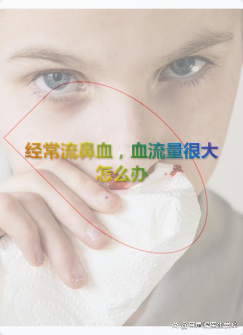 流鼻血量不多是什么原因