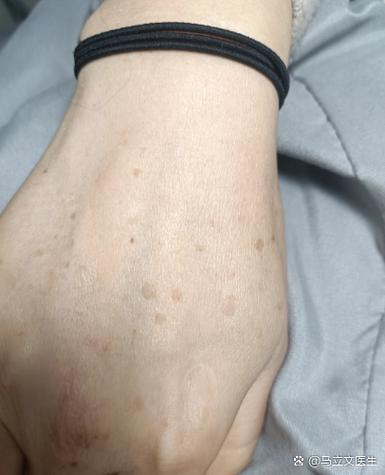 老化的特征有哪些 老化的特征有哪些