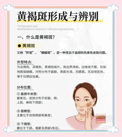 雀斑怎么治疗才能彻底除根